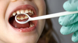 dentist checking a young girl's teeth